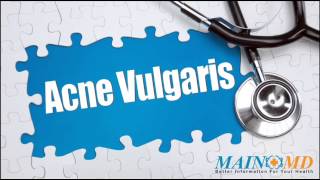 Acne Vulgaris ¦ Treatment and Symptoms [upl. by Nerra645]