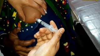 Arm injection IM Soma Ject Injection Push √√ Injection Video  জন্মবিরতিকরণ ইনজেকশন 24 Ep14 [upl. by Pavia309]