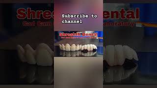 dentallaboratory dentist smile dentalformula dentalwork teethwhitening dentaltechnician [upl. by Noryb]