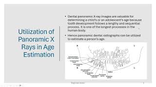 Age Determination Using a Panorex Radiograph with the help of Nolla’s Stages of Tooth Development [upl. by Inaflahk]