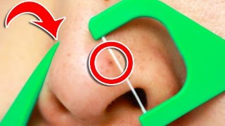 6 Clever Tricks To Unclog Pores INSTANTLY [upl. by Ohcirej]