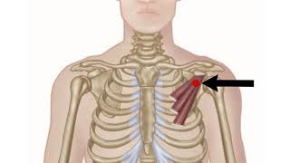 Pectoralis Minor  Trigger Point Therapy  Anatomy Tutorial [upl. by Roeser]