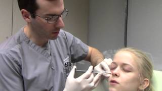 Juvederm VOLUMA injected under the eyes with Dr Seiler [upl. by Cohlette]