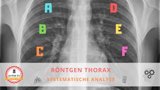 Systematische Bildanalyse eines Röntgen Thorax [upl. by Manbahs]