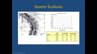 What’s Happening in Osteoporosis [upl. by Ynatsed726]