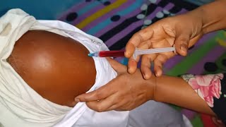 Arm Injection Push Vitamin B1B6B12 injection video Nugesic 24 Ep 32 By Injection Media [upl. by Ileak]