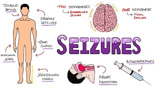 Seizures  Seizure Types  Generalized vs Focal Seizures  Causes of Seizures Mnemonic [upl. by Endres]