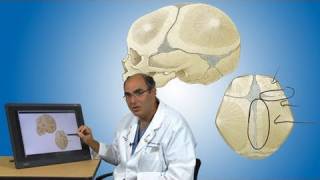 Craniosynostosis and its treatment  Boston Children’s Hospital [upl. by Frank]