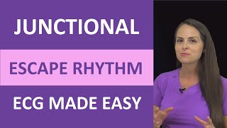 Junctional Escape Rhythm ECG Made Easy Nursing Next Generation NCLEX EKG [upl. by Akirdnuhs256]