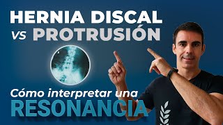 ★ Hernia discal VS Protrusión discal Cómo interpretar una resonancia  ✅ 10 EJERCICIOS [upl. by Anilorak939]