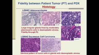 PatientDerived Xenografts for Cancer Therapeutics Development and Predictive Modeling [upl. by Dore]