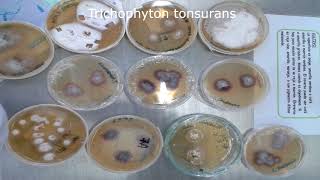 Dermatofitosis  Trichophyton spp  Cultivo  Pura Ciencia [upl. by Quentin]