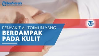 Dermatitis Herpetiformis Penyakit Autoimun yang Berdampak pada Kulit karena Bereaksi dengan Gluten [upl. by Nerrej]