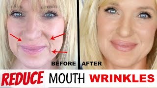 Get RID Of MOUTH WRINKLES WithOUT Fillers [upl. by Ynabe386]