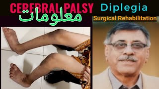 Spastic Cerbral Palsy Diplegia Detailed overview  Surgical and Rehabilitation Treatment Pathways [upl. by Keelia]