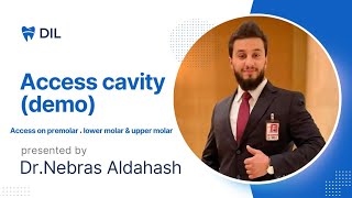 Access cavity demo  DrNebras Aldahash [upl. by Yllah946]