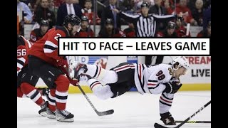 Connor Bedard Injury  Hit to the Face  Reaction [upl. by Hosea256]