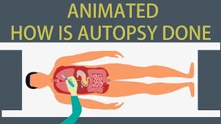 Autopsy Detailed animation on how is Autopsy done [upl. by Enitram270]