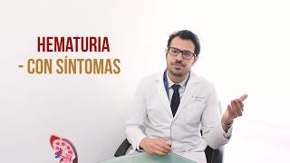 ¿Qué es la hematuria en la orina Sangrar al orinar [upl. by Ecirtak]