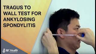 Tragus to Wall test for Ankylosing Spondylitis [upl. by Meares562]