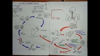 strongyloides stercoralis [upl. by Yurt]