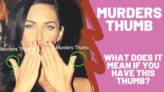 Murders Thumb – What Does it Mean if You Have a Clubbed Thumb Brachydactyly – Hand Analysis [upl. by Ahsinnek]