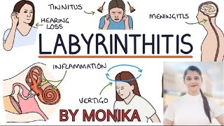 Lecture on LABYRINTHITIS [upl. by Haissi148]