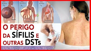 O perigo da Sífilis e outras DSTs [upl. by Brynne]