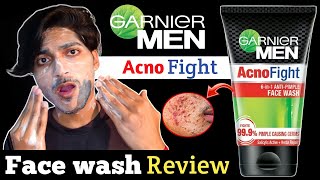 Garnier Acno Fight Face Wash Review  Garnier Acno Fight Face Wash  Garnier Face Wash For Men Acne [upl. by Quirita]