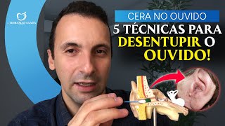 Como Desentupir o Ouvido e Quanta Cera Retirar 5 Técnicas diferentes e como deve limpar em casa [upl. by Ecila]