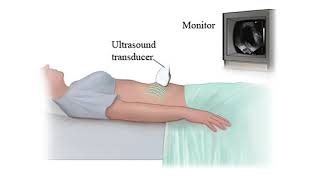 Learn more about the Pelvic Scan [upl. by Neztnaj293]