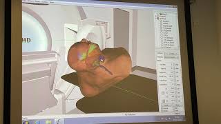 Virtual Experience of a Radiotherapy Treatment Room  Leeds Cancer Centre [upl. by Gavrilla]