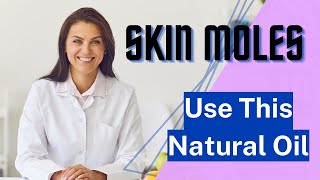 Healing Natural Oils HMoles Formula Review  Get Rid of Moles On Your Skin [upl. by Frodin761]