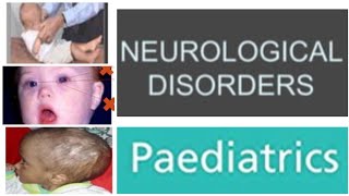 2 Neurological Disorders Paediatrics  Pyogenic Meningitis  Def PathogensisClinical Findings [upl. by Danielle965]