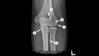 FRCR Radiological anatomy course upper limb 1  Arabic edition [upl. by Hobey]