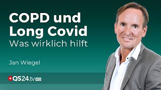 Stammzellen in der Bekämpfung von COPD und Long Covid  Erfahrungsmedizin  QS24 [upl. by Anivid]