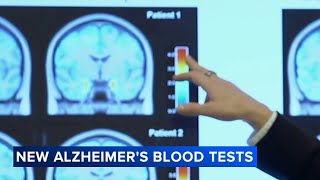 Blood test can help doctors diagnose Alzheimers faster researchers [upl. by Adala]