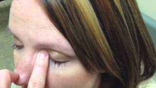 How to apply eye drops  UTMB Heath Eye Center [upl. by Oramug890]