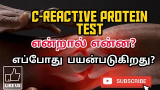 CREACTIVE PROTEIN TEST CRP TEST  USES  METHOD  NORMAL RANGE  PHARMA TAMIL  AKI  36 [upl. by Bamberger6]