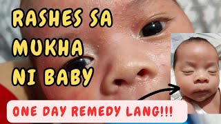 RASHES SA MUKHA ni baby NEONATAL ACNE REMEDY by Dr Pedia Mom [upl. by Leik]