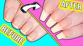 How to GROW YOUR NAILS FAST actually helpful information [upl. by Barbe89]