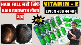 How To Use Vitamin E Capsule For HAIR GROWTH  Evion 400 Vitamin E Capsules For Hair amp Skin [upl. by Annai]