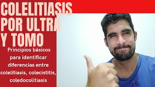 Colelitiasis y colecistitis diferencias clínicas y por ultrasonido [upl. by Franciskus]