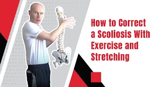 How to Correct a Scoliosis With Exercise and Stretching  Edward Paget [upl. by Mou]