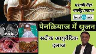 पैंक्रियाज में सूजन  Pancreatitis  का Ayurvedic Treatment । Padmshri vaidya Balendu Prakash [upl. by Ahtnama]