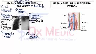 1 TRAUMA TORACICO Y INSUFICIENCIA VENOSA [upl. by Eynobe]