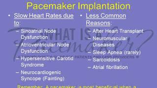 Pacemaker Patient Education Lecture 2 Reasons for Pacemaker Implantation [upl. by Eimme]