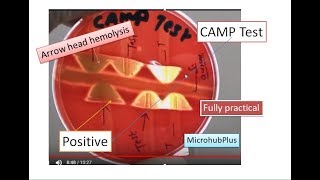 CAMP test CAMP Factor  CAMP Reaction  Microbiology Streptococcus agalactiae [upl. by Gauntlett580]