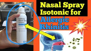 बच्चों में एलर्जी । Allergy in Children । Allergic rhinitis । एलर्जी का इलाज । Treatment of allergy [upl. by Occir500]