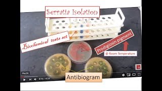 Serratia  the simplest way of identification and isolation from specimens  Serratia marcescens [upl. by Nahc]